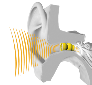 Fit_and_forget_hassle-free_hearing.png